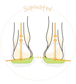 Mit jelent az, hogy supinalt cipő?